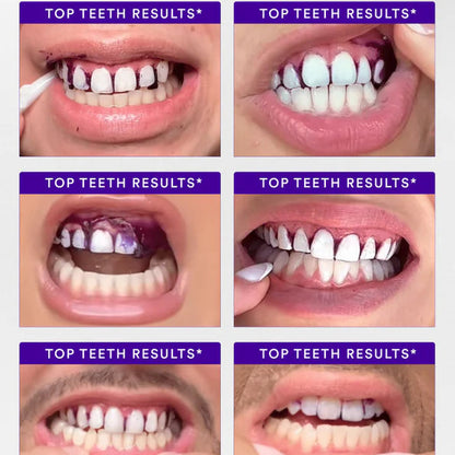 Volora Shine™ Purple Whitening Strips